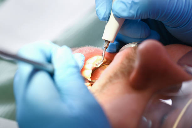 Best Broken Tooth Emergency  in Gunnison, UT