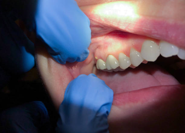 Best Teeth Whitening  in Gunnison, UT