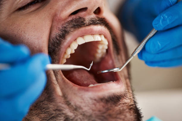 Best Teeth Whitening  in Gunnison, UT