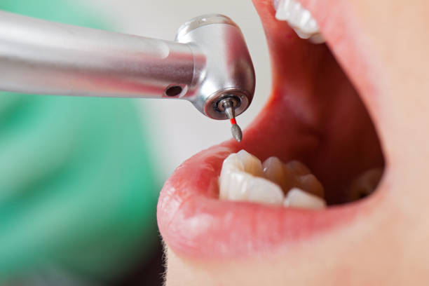 Tooth Infection Emergency Dentist in UT